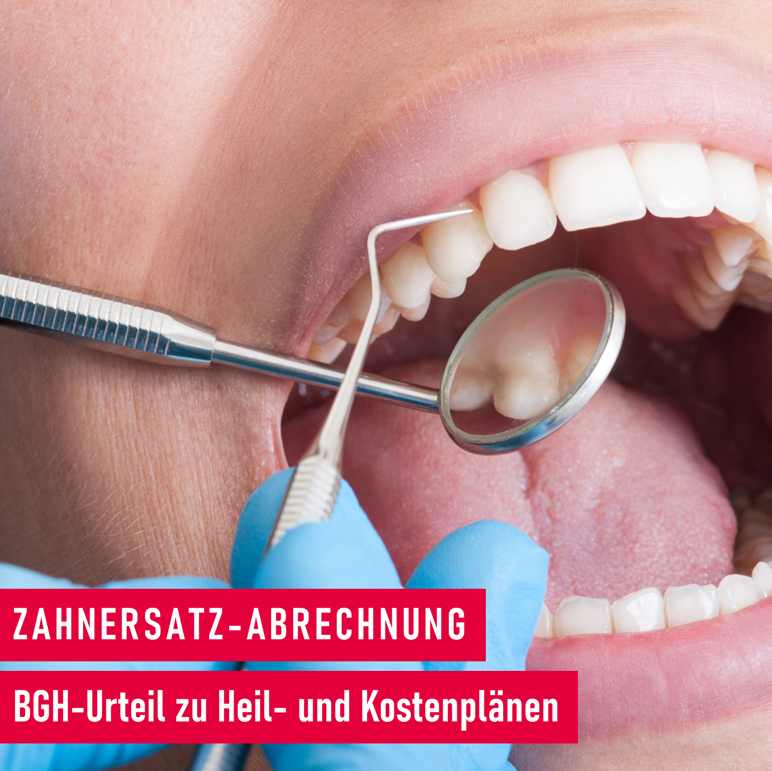 Zahnersatz-Abrechnung: BGH-Urteil zu Heil- und Kostenplänen